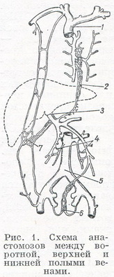 Схема анастомозов между воротной, верхней и нижней полыми венами